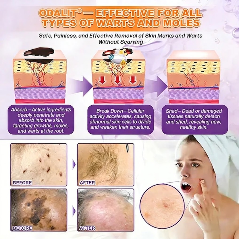 (Get an additional bottle at the best discount!)🍀ODALIT® Restoration Cream