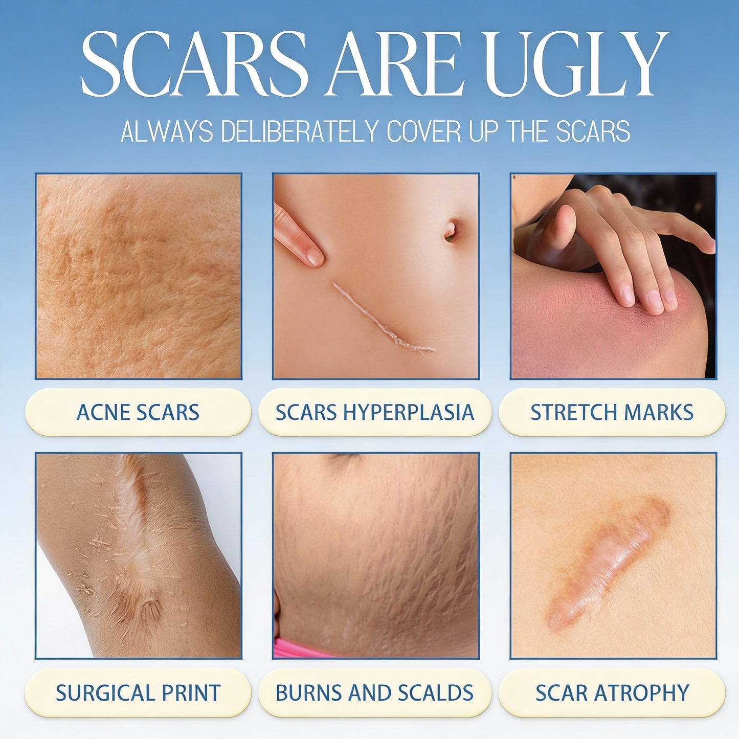 𝑶𝒇𝒇𝒊𝒄𝒊𝒂𝒍 𝑺𝒕𝒐𝒓𝒆 | LBMLBM® Science-Backed Scar Removal Cream: Restore Your Skin’s Natural Texture in as little as 4 Weeks