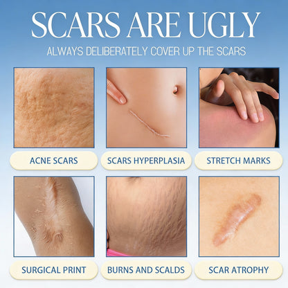 𝑶𝒇𝒇𝒊𝒄𝒊𝒂𝒍 𝑺𝒕𝒐𝒓𝒆 | LBMLBM® Science-Backed Scar Removal Cream: Restore Your Skin’s Natural Texture in as little as 4 Weeks