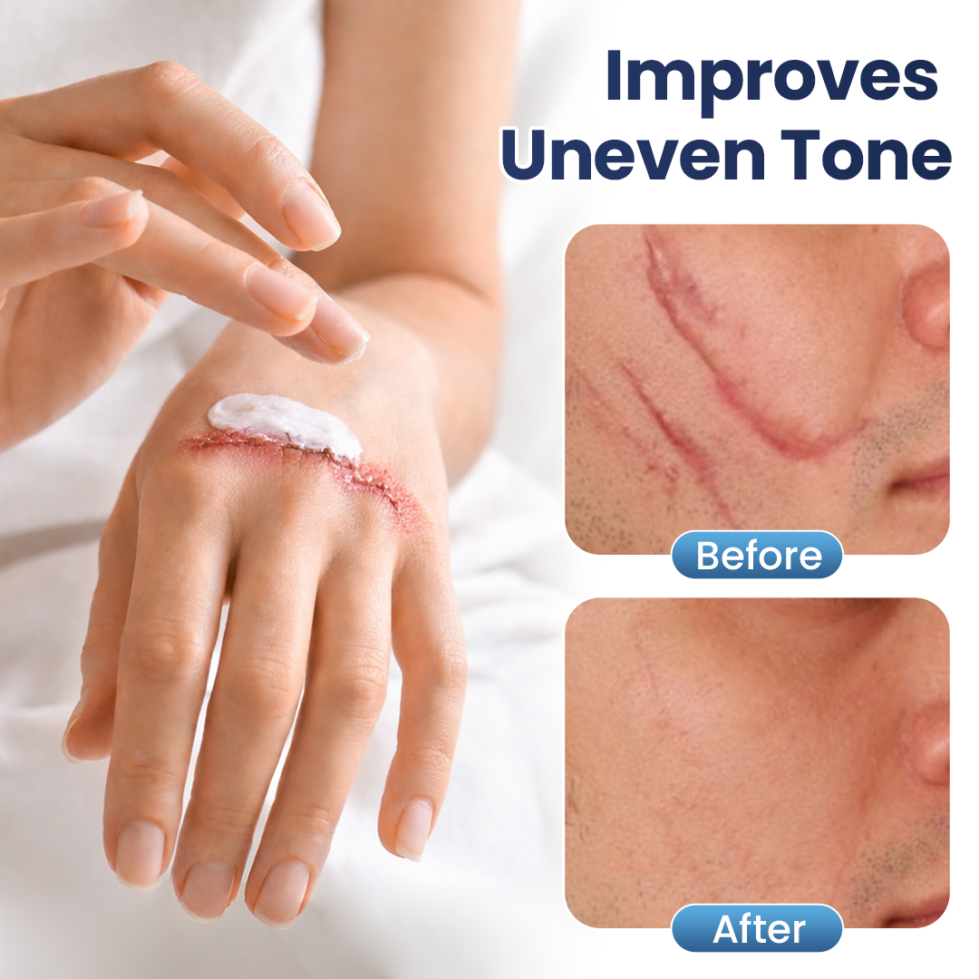𝑶𝒇𝒇𝒊𝒄𝒊𝒂𝒍 𝑺𝒕𝒐𝒓𝒆 | LBMLBM® Texture Repair Gel — Say Goodbye to Stubborn Scars & Uneven Texture in 4 Weeks