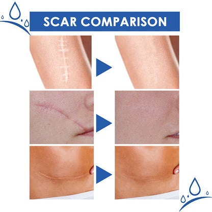 ❤️50% OFF Sale🔥𝑶𝒇𝒇𝒊𝒄𝒊𝒂𝒍 𝑺𝒕𝒐𝒓𝒆 | LBMLBM® Scar Removal Cream — Restore Skin & Regain Confidence🌹