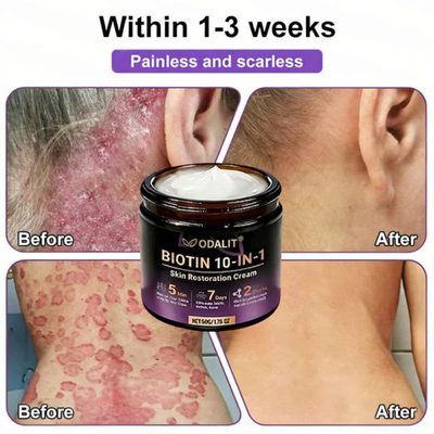 (Get an additional bottle at the best discount!)🍀ODALIT® Restoration Cream