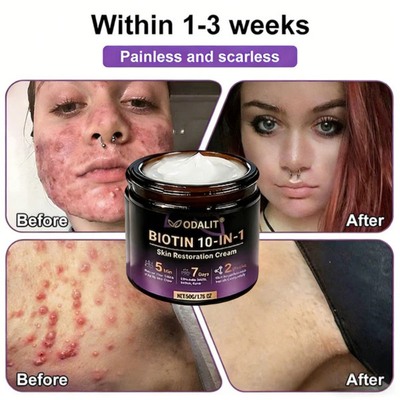 (Get an additional bottle at the best discount!)🍀ODALIT® Restoration Cream