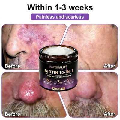 (Get an additional bottle at the best discount!)🍀ODALIT® Restoration Cream
