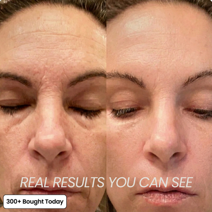 ⚡50% OFF⚡LBMLBM® All In One Collagen Skin Care Wrinkles Treatment Balm