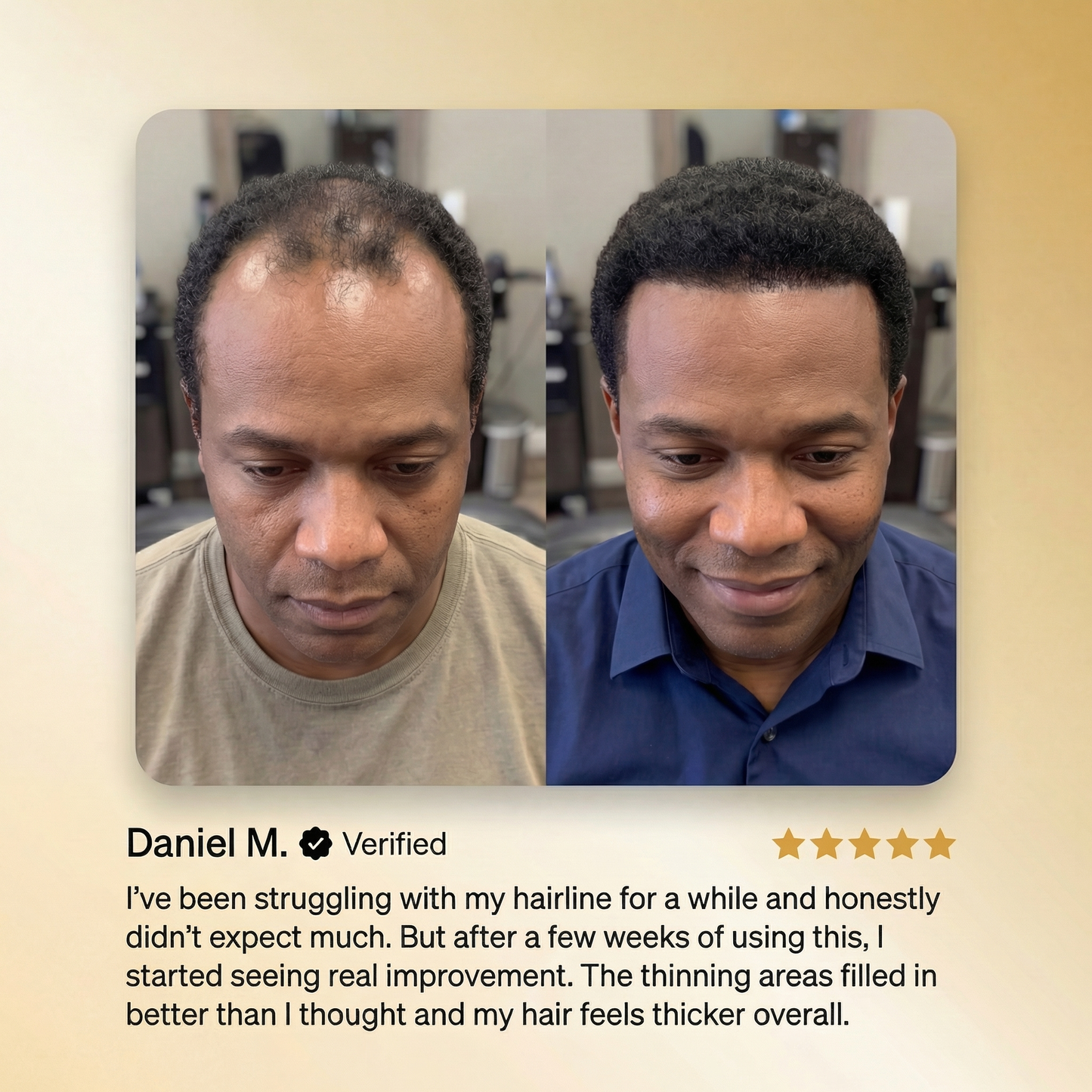 ODALIT Advanced Batana Hair Regrowth Therapy